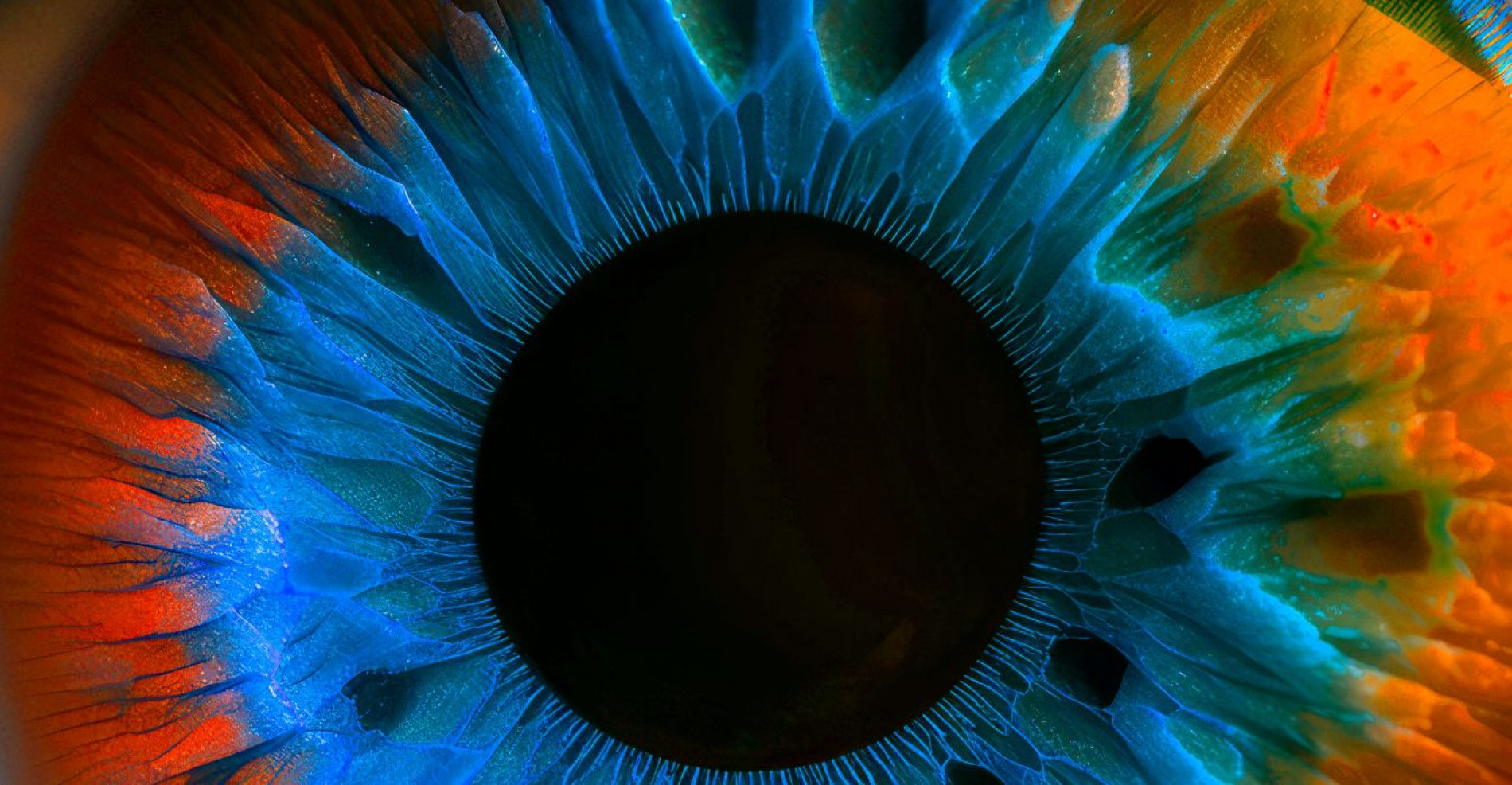 HEADER RETINA